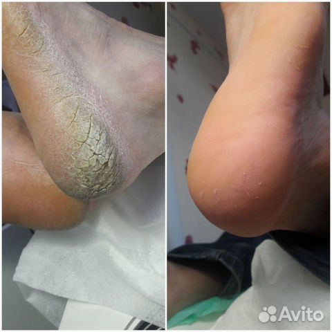 Smart Педикюр мужской, женский. Маникюр