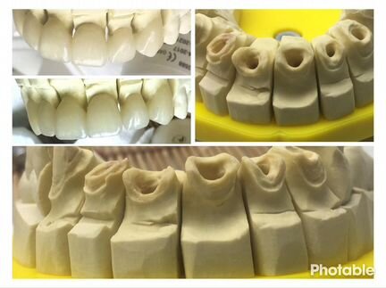 Зубной техник