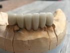 Зубной техник- сотрудничество с врачом ортопепедом
